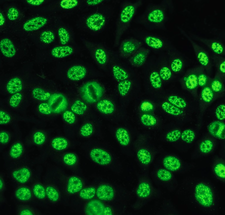 <ul><li><p><span><u>Detected against saline extractable nuclear antigens</u></span></p><ul><li><p><span><u>anti-RNP, anti-Sm</u></span></p></li></ul></li><li><p><span>Anti-Sm: highly specific for SLE</span></p></li><li><p><span>Anti-RNP: SLE, RA, Sjogrens, PSS, MCTD, dermatomyositis</span></p></li></ul><p></p>