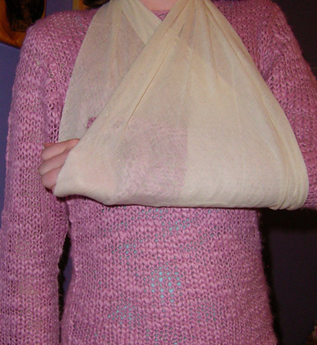 <p>a device that uses a strap, piece of cloth, or ropes for supporting, lifting, or carrying objects: Dây đeo tay</p><p>Synonyms: Arm support, arm brace</p><p>Example: He wore a sling after breaking his arm</p>