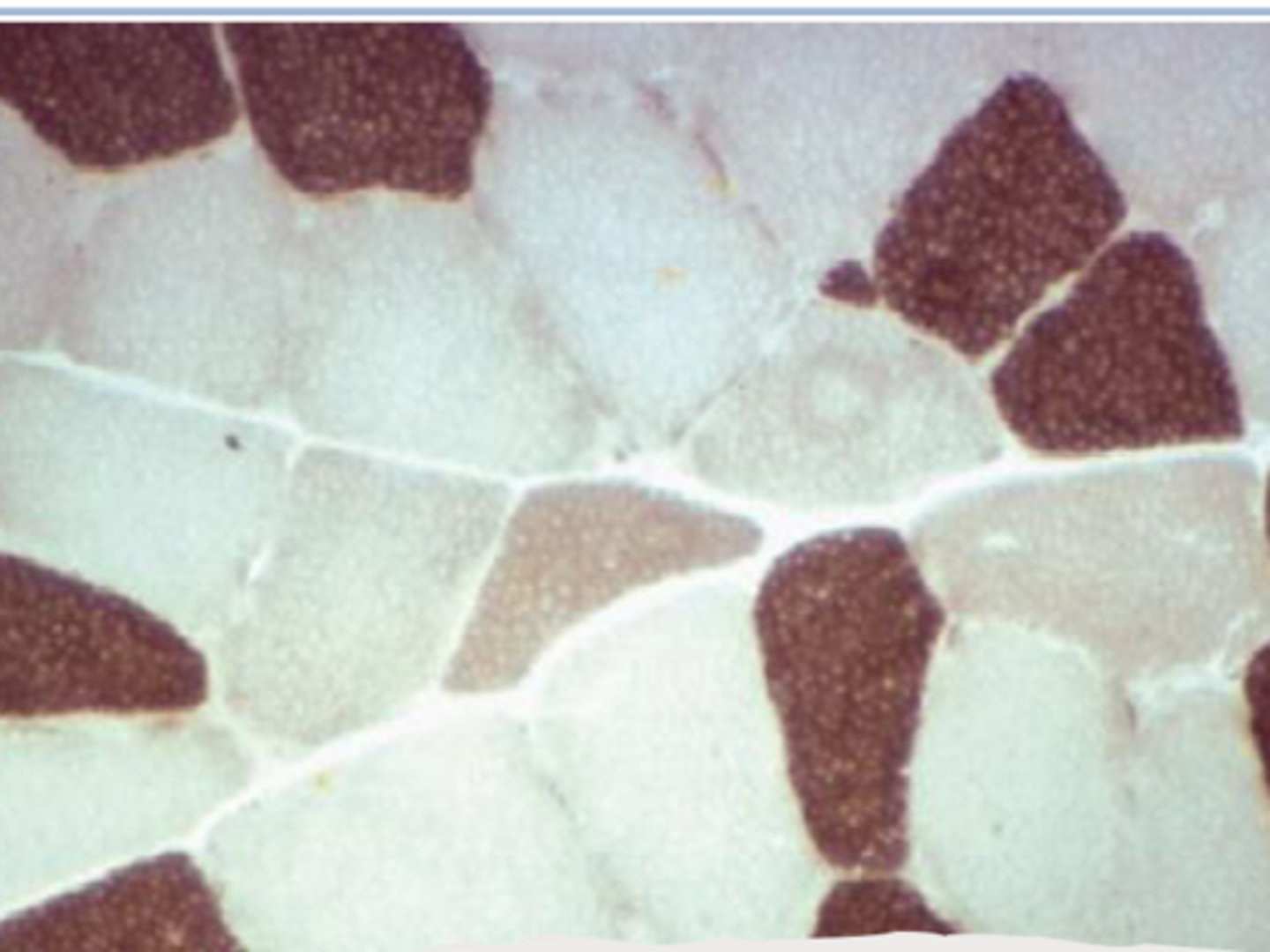 <p>What are Type 2b SK muscle fibers?</p>