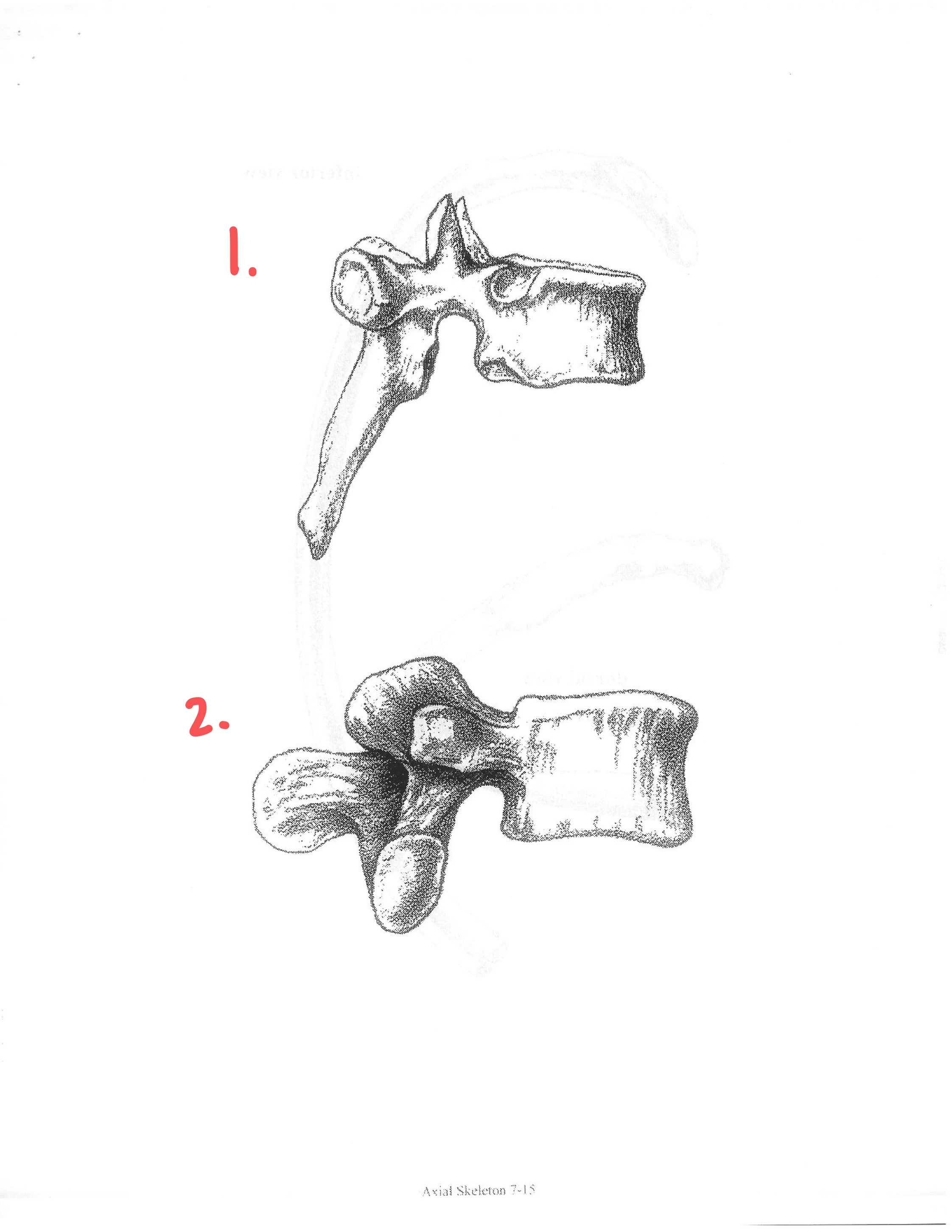 <p>ID both vertebrae</p>
