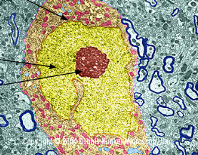 <p>yellow</p>