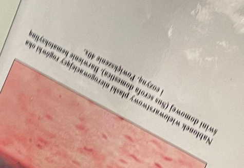 <p>ciągle powstają nowe komórki, jest gruby więc dobrze chroni</p>