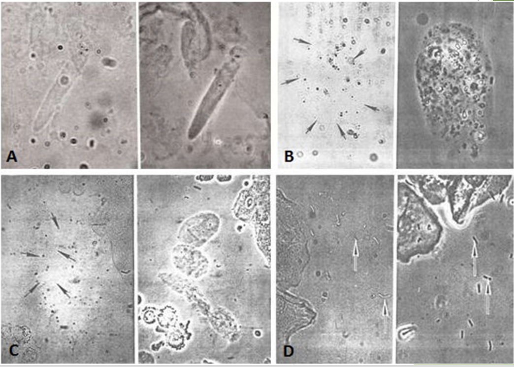 <p><span>Most commonly used microscope </span></p>