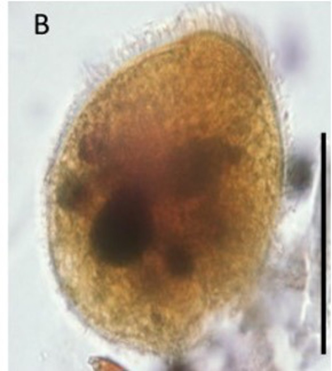 <p>Found in a pig whose owner had intestinal disease. What parasite is this?</p>