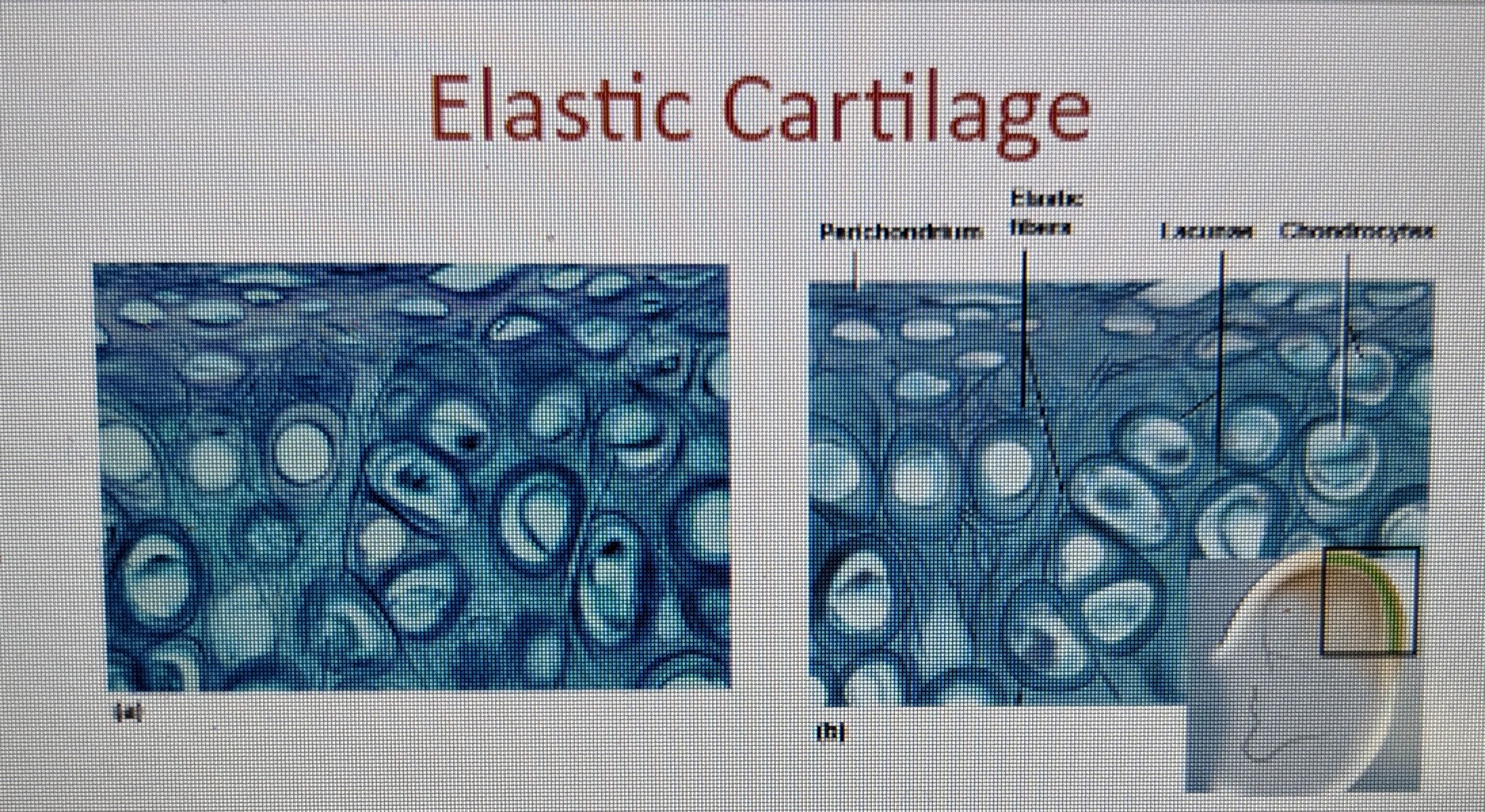 contains abundance of elastic fibers; provides flexible, elastic support 

* covered with perichondrium  
* fibers oriented in many different directions, gives very flexible support 
* location: external ear, epiglottis 