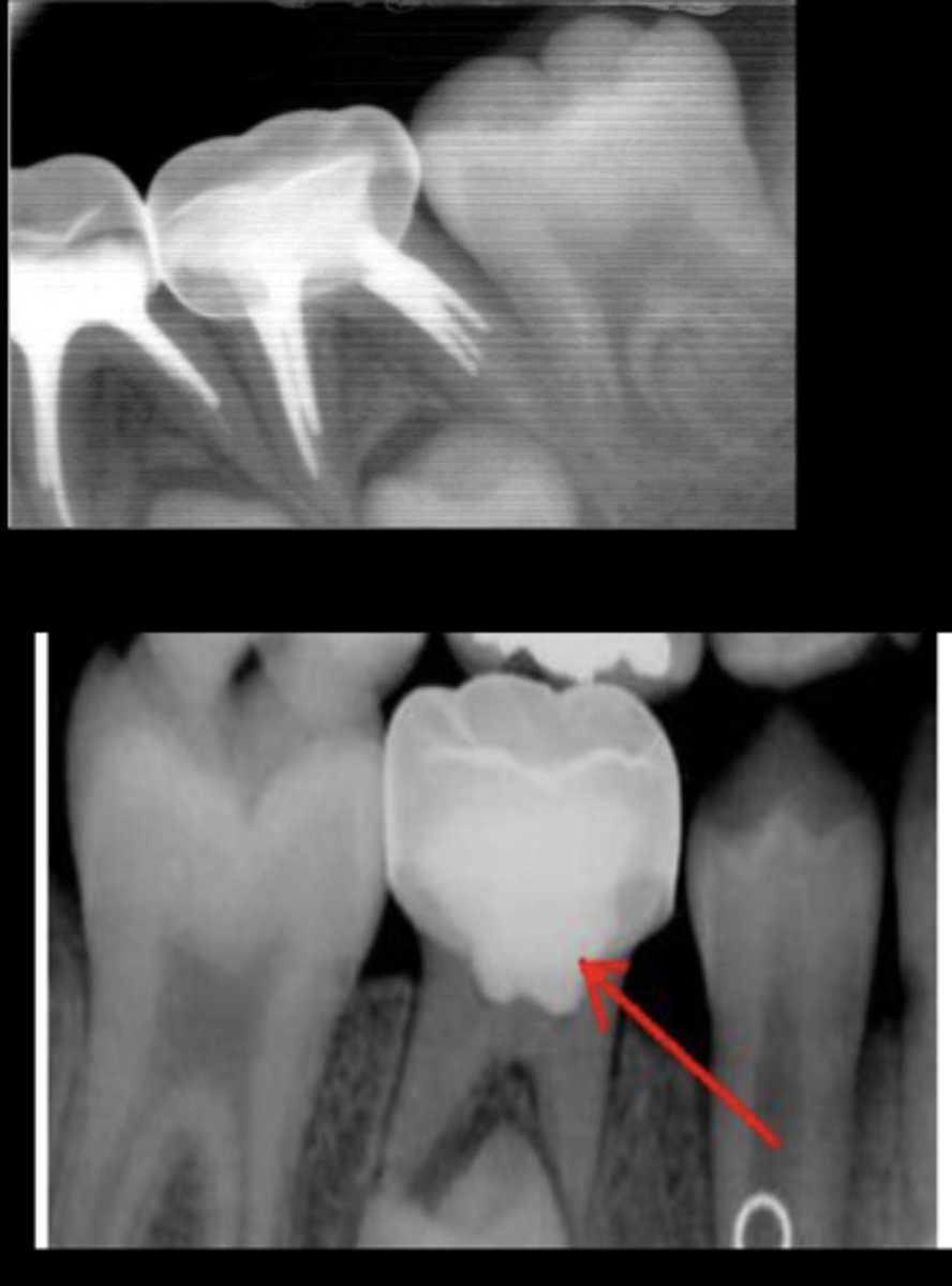 <p>What crown is this?</p>