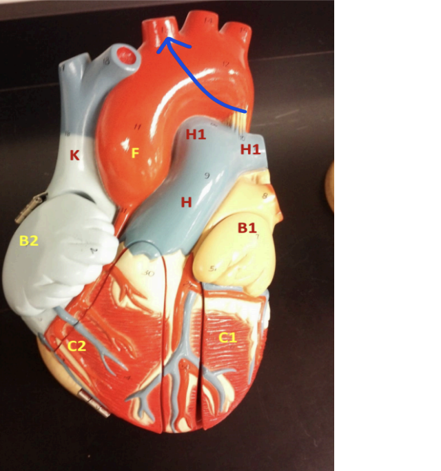 <p>What branch of aorta is the arrow pointing to? </p>