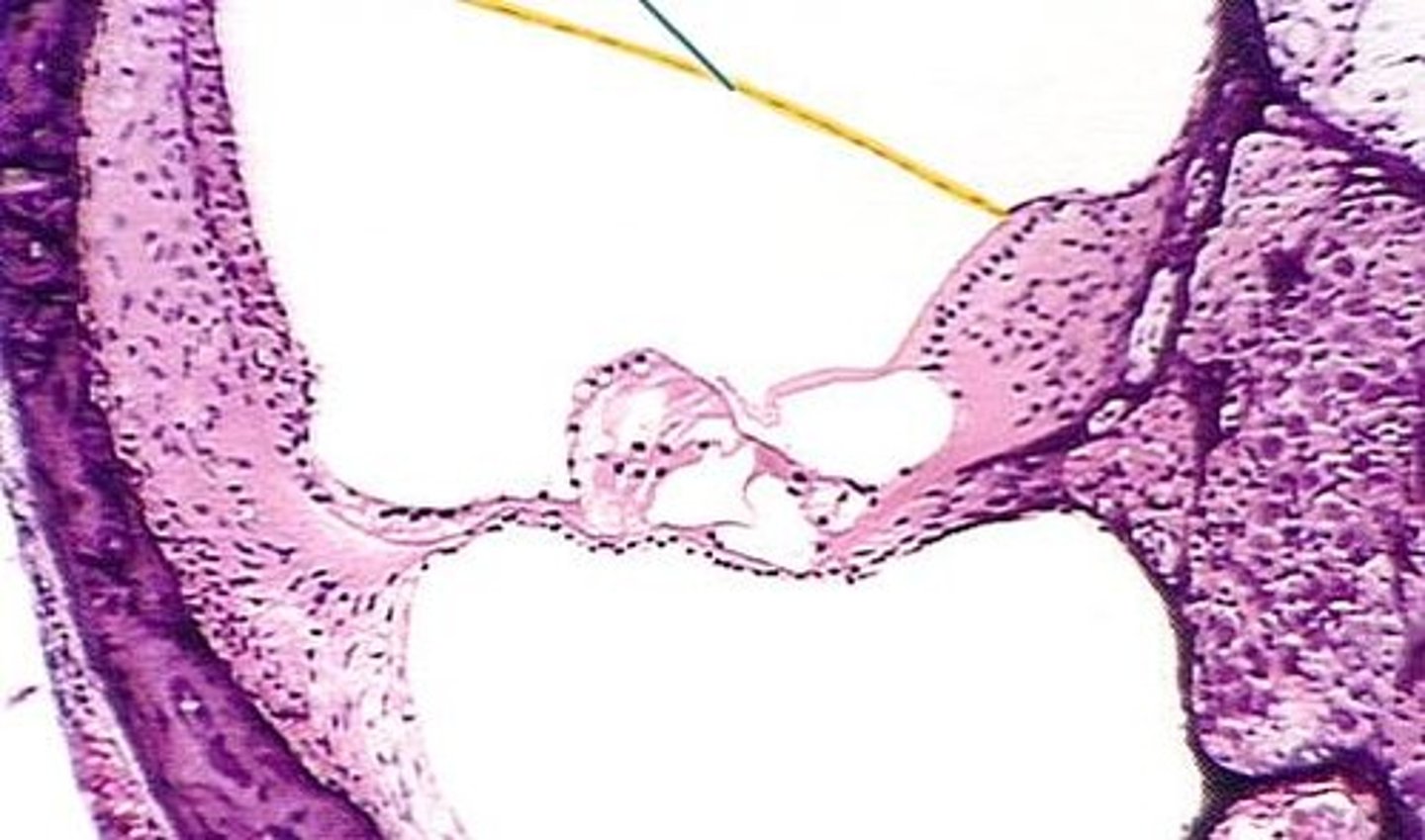 <p>Name the yellow line</p>