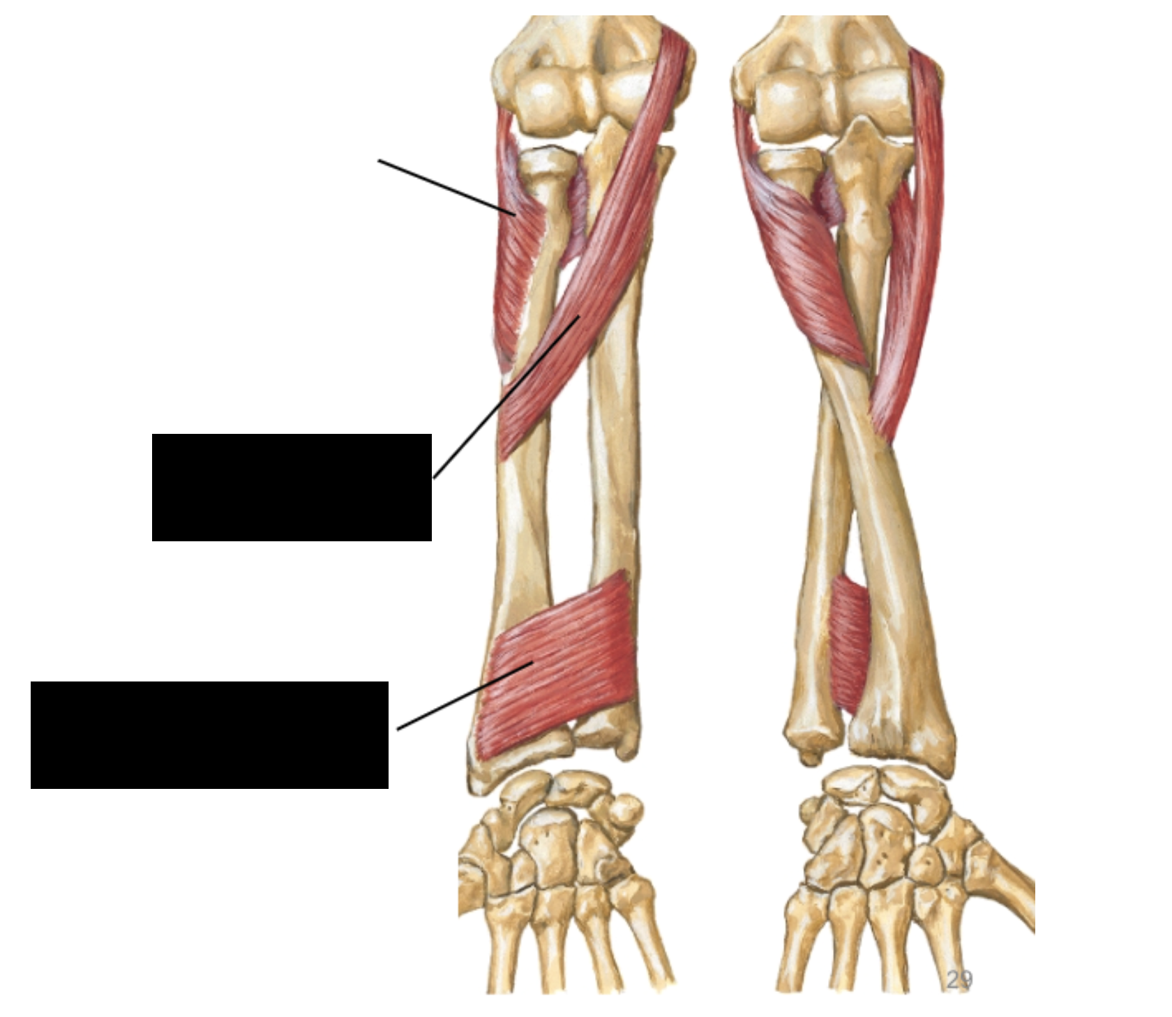 term image