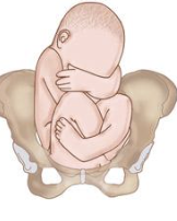 <p>Both hips and knees are flexed </p>