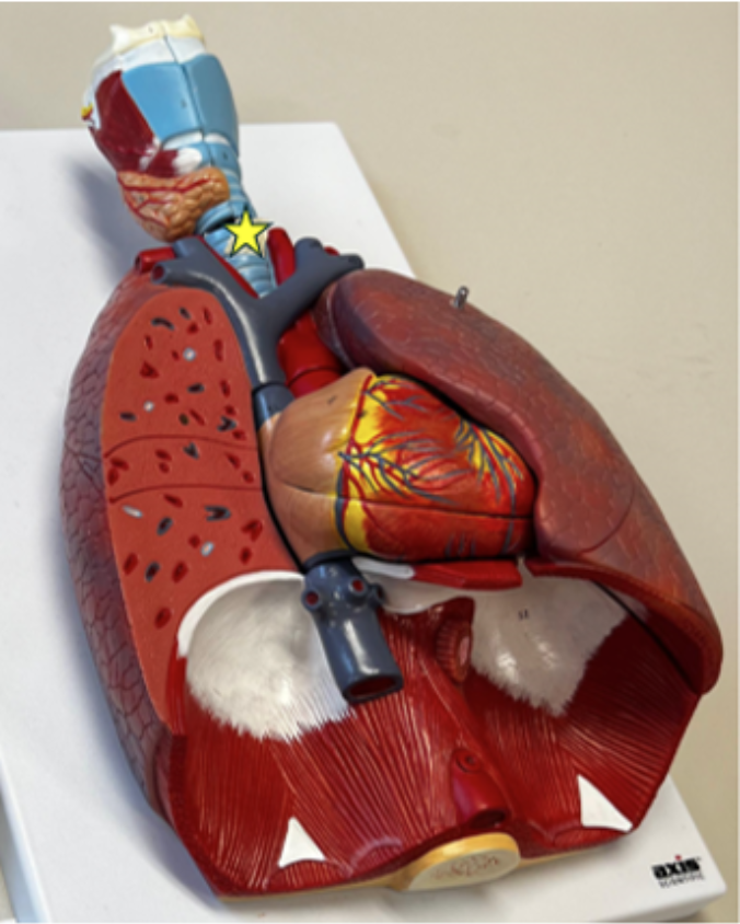 <p>What structure is denoted with a star? </p>