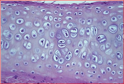<p>Bond structures, provide support and protection and have an abundant extracellur matrix </p>
