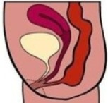<ol><li><p>Is this image of the pelvis normal or abnormal?</p></li><li><p>If abnormal, what can be assumed here?</p></li></ol><p></p>