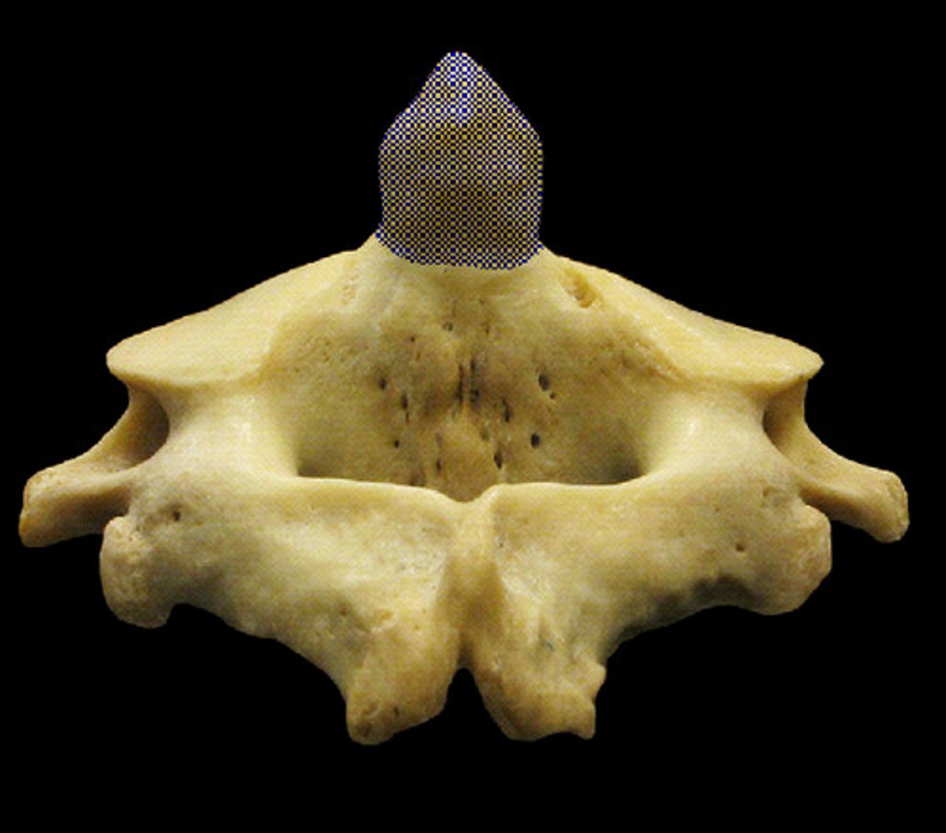 <p>Name the structure.</p>