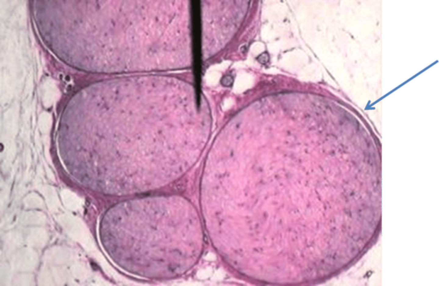 <p>A nerve that branches from a plexus and supplies sensory and motor functions to many areas of the body.</p>