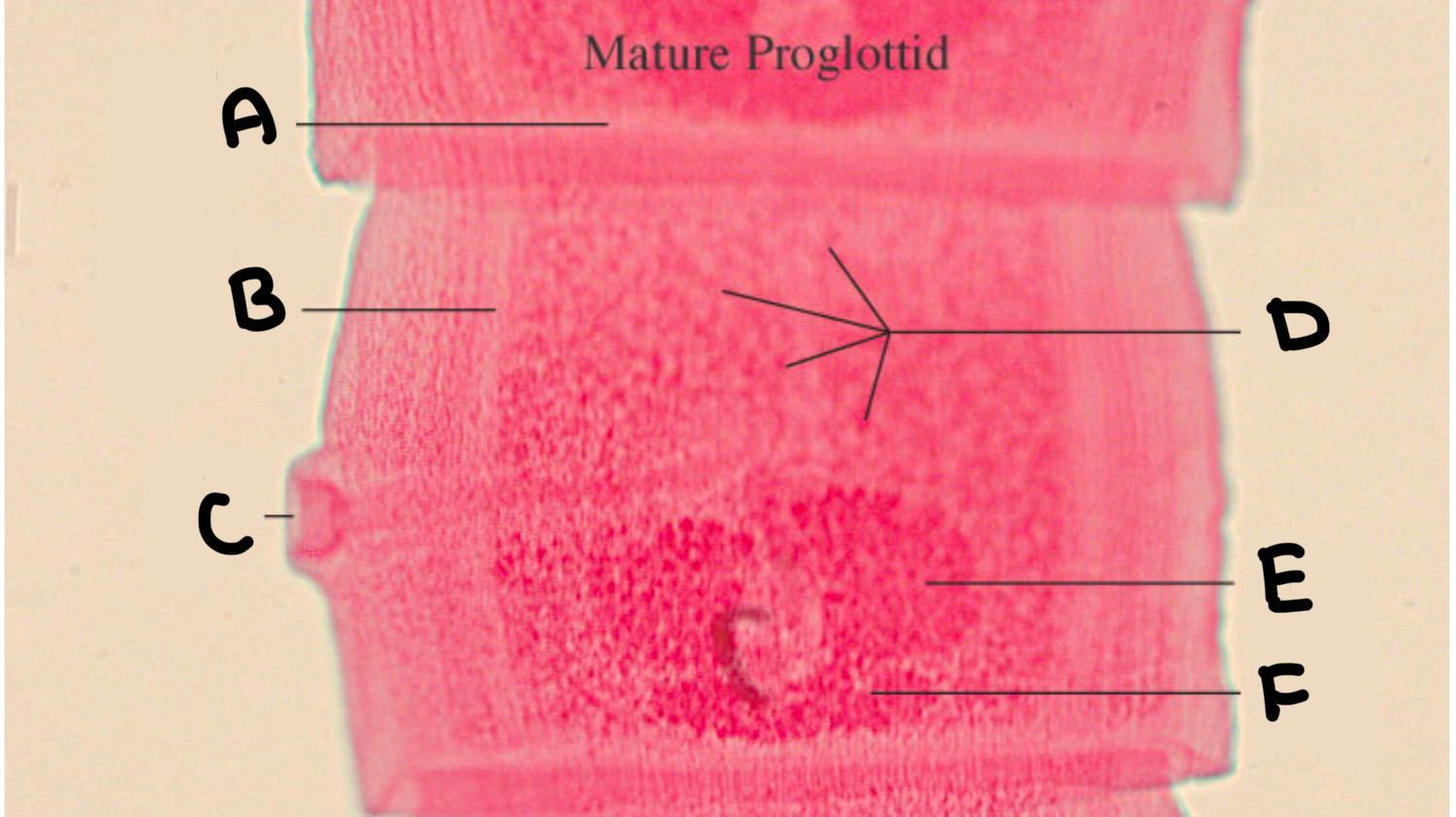 <p>What part of the tapeworm is labeled F</p>