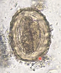 <p>Identify the type of parasite.</p>