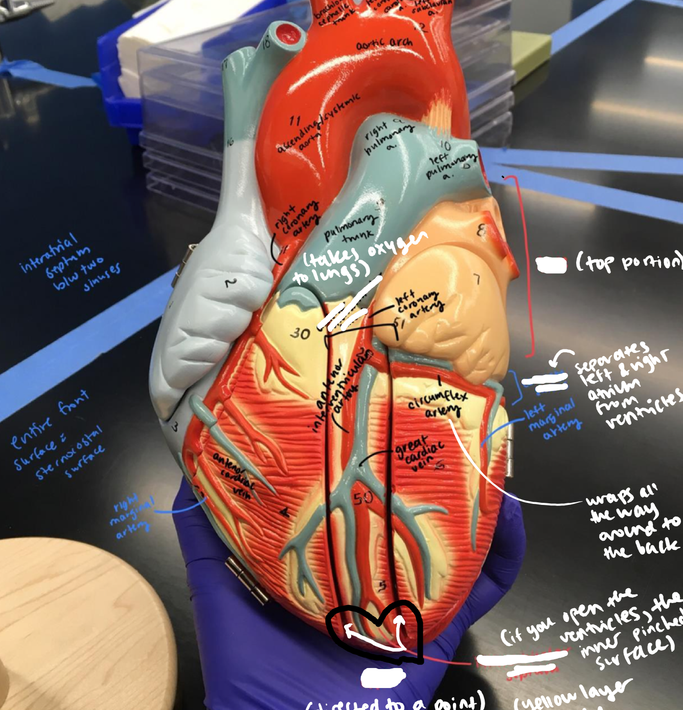 <p>If you open the ventricles, the inner pinched surface</p>