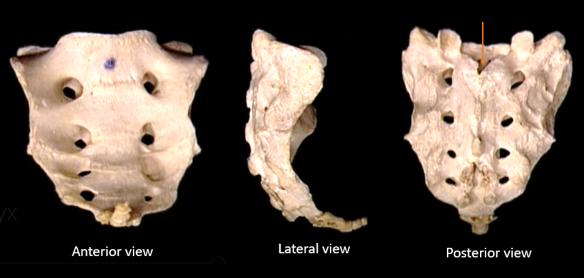 sacral canal 