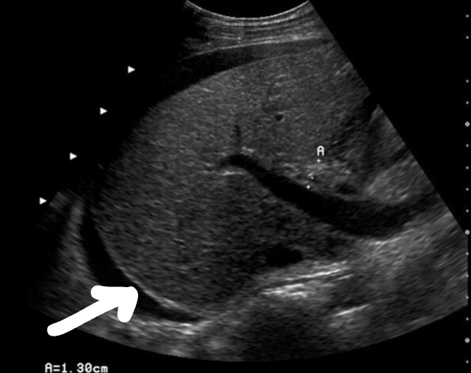 <p>What is the arrow pointing at? And what are the anechoic areas?</p>