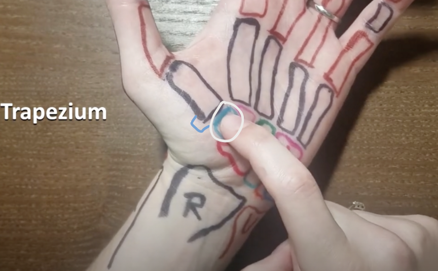 <p>found at the end of the 1st metacarpal </p>