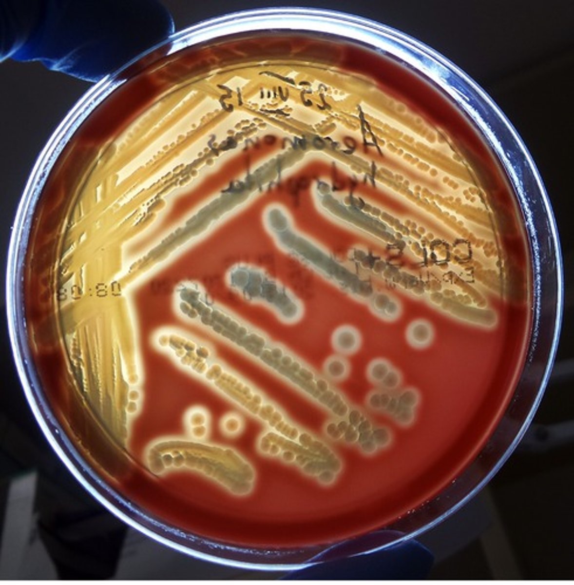<p>Gram negative fermentative bacilli.</p><p>Beta hemolytic on blood.</p><p>Cream colored colonies on MacConkeys .</p><p>Oxidase positive.</p><p>Catalase positive.</p>