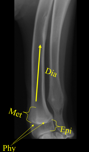 <ul><li><p><strong><u>Epiphysis</u></strong></p><ul><li><p><strong>end</strong> of bone, articular part</p></li></ul></li><li><p><strong><u>Physis</u></strong></p><ul><li><p><strong>growth</strong> plate or line</p></li><li><p><strong>Distal radial plate</strong></p><ul><li><p><strong>80% </strong>of growth, closes 9 mths </p></li></ul></li><li><p><strong>Distal ulna plate</strong></p><ul><li><p><strong>85% </strong>of growth, closes 10 mths</p></li></ul></li></ul></li><li><p><strong><u>Metaphysis</u></strong></p><ul><li><p><strong>widened</strong> part between shaft and growth plate</p></li></ul></li><li><p><strong><u>Diaphysis</u></strong></p><ul><li><p><strong>shaft</strong> of long bone</p></li></ul></li></ul><p></p>