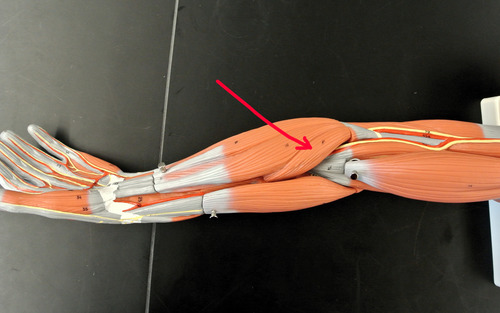 <p><span style="font-family: Arial, sans-serif">What is the origin and insertion of this muscle?</span></p>