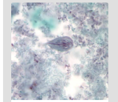 Trophozoite