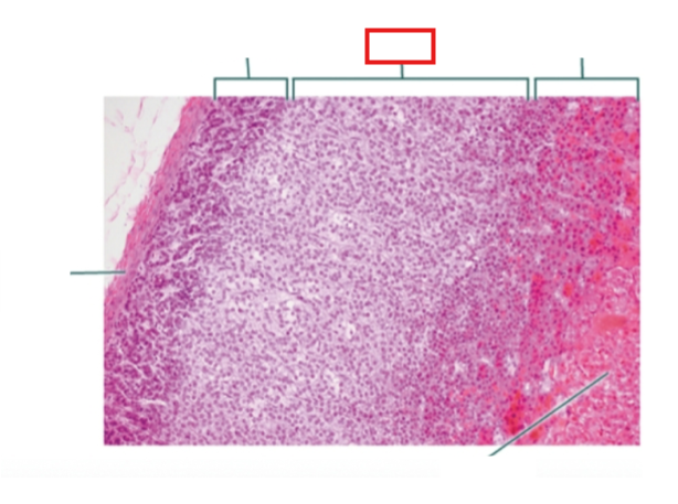 <p>What structure is highlighted?</p>