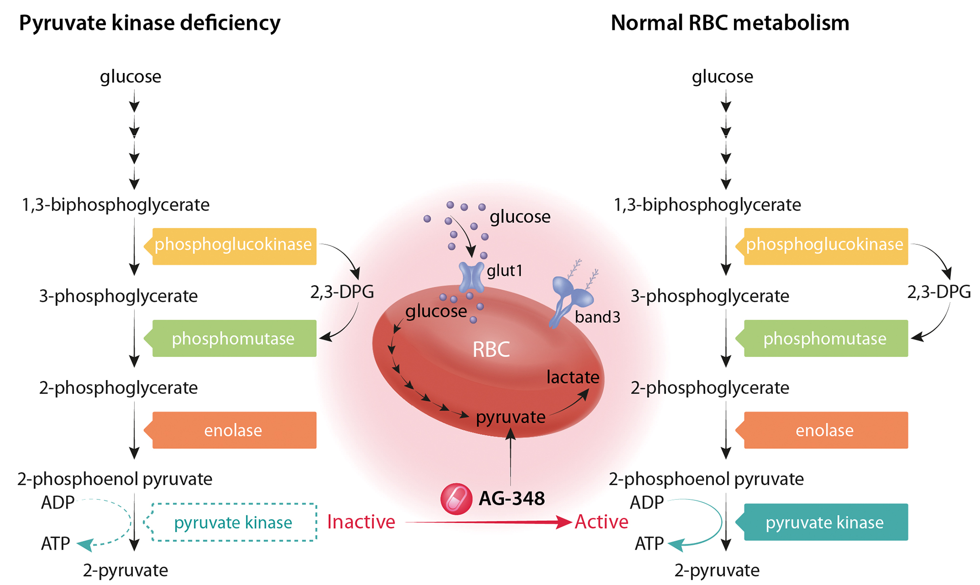 <ul><li><p>Autosomal RECESSIVE</p></li><li><p>Embden-Meyerhof pathway defect → reduced life span of RBC (deformed, severe)</p></li></ul><p></p>