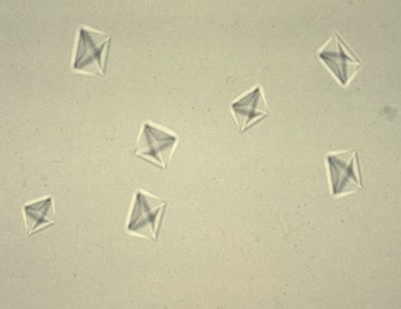 <p><span style="color: rgb(0, 0, 0)">What are these crystals called?</span></p><p><span style="color: rgb(0, 0, 0)">Do these crystals like alkaline or acidic urine?</span></p><p><span style="color: rgb(0, 0, 0)">Are they a common crystal &amp; in what animals?</span></p>