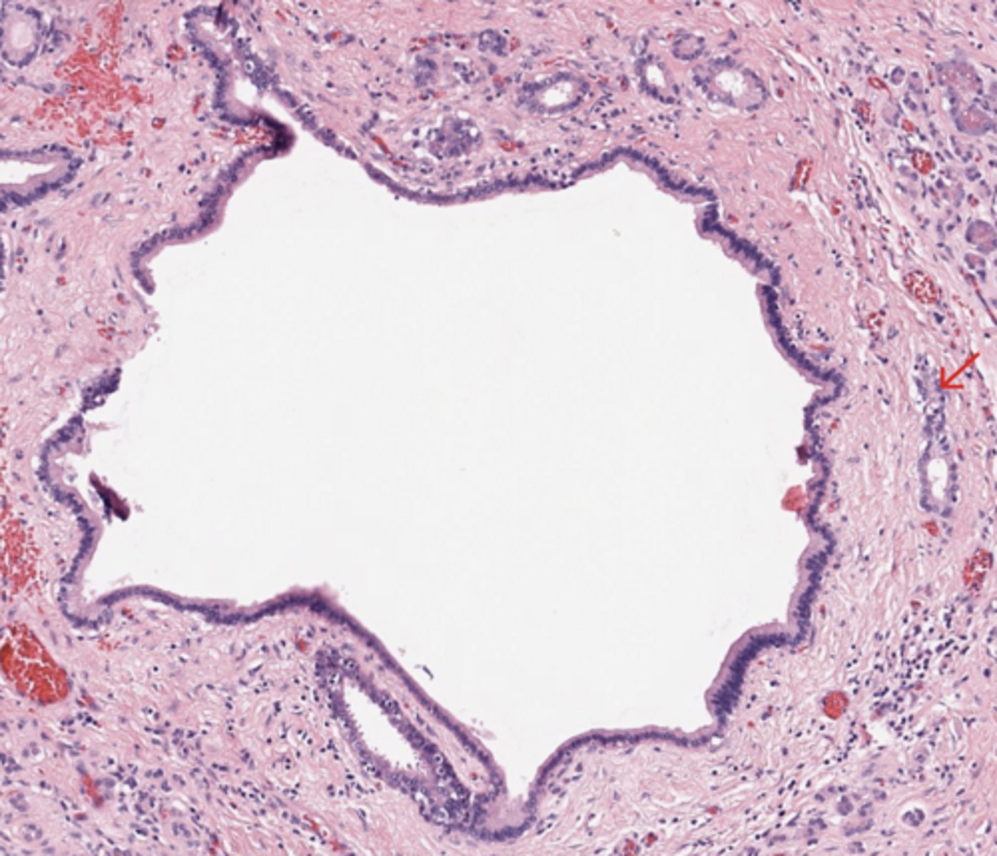 <p>Pancreas</p>