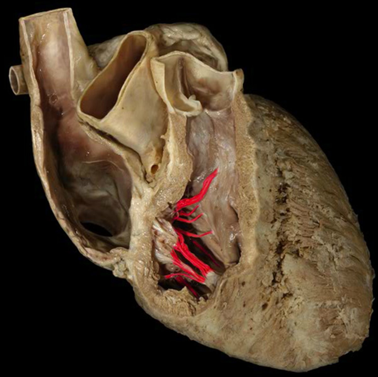 <p>String-like tendons used to attach the atrioventricular valves of the heart to the sides of the ventricle wall. Sometimes called heart strings.</p>