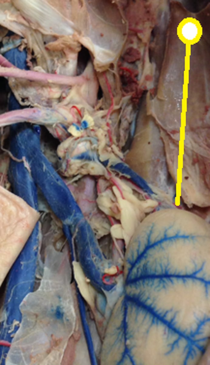 <p>Not attached to kidney, above kidney</p>