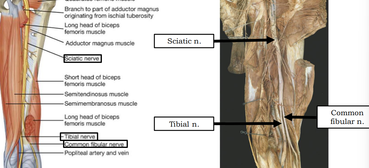 <p>Sciatic n. (sacral plexus)</p>