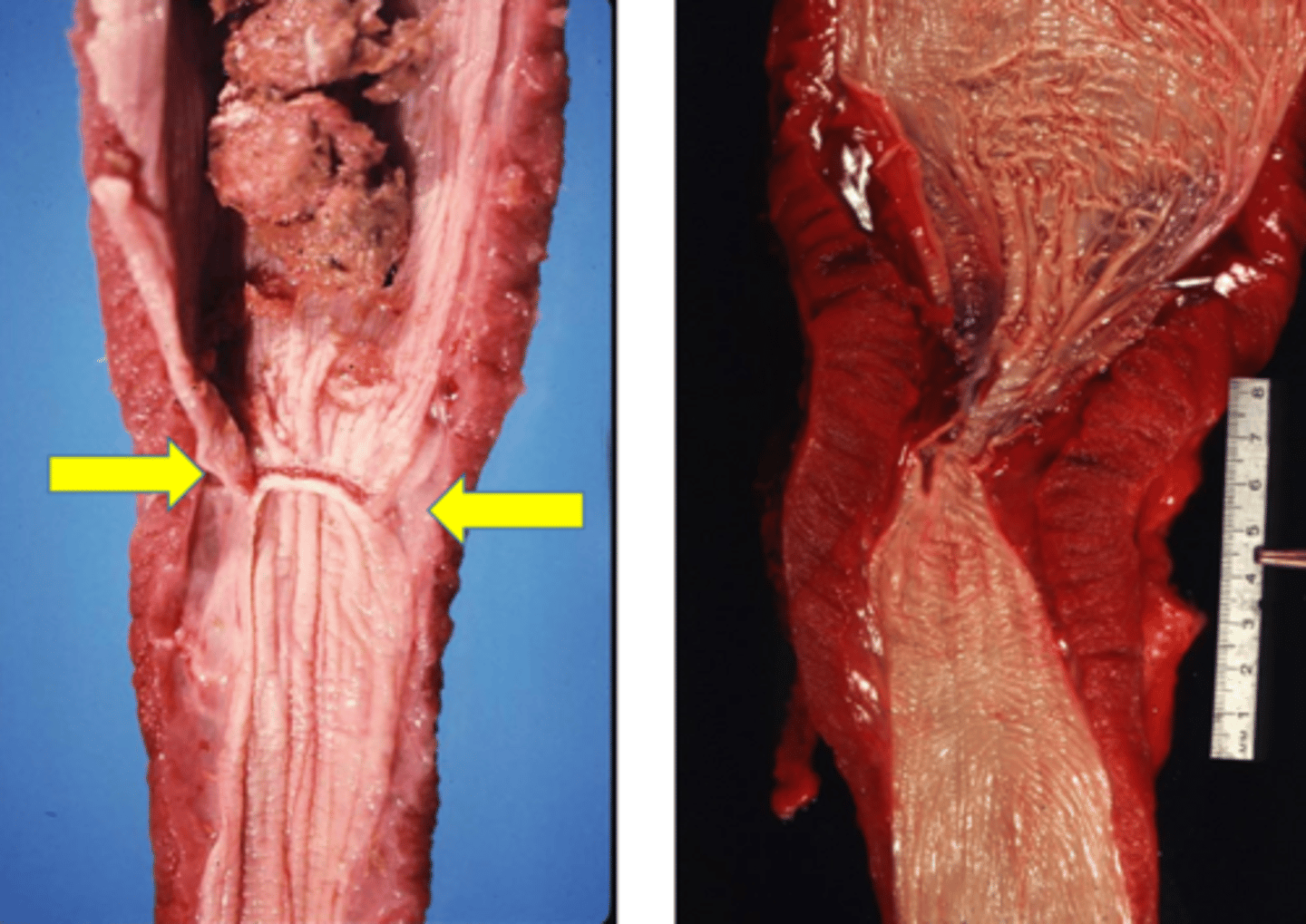 <p>Identify the pathology?</p>