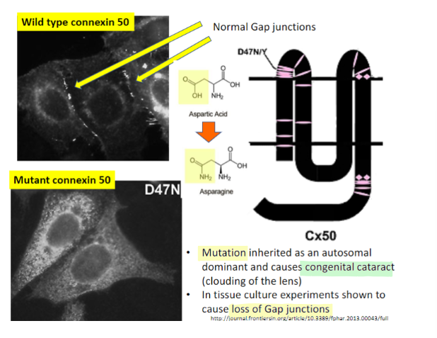 <p>congenital cataracts</p><ul><li><p>lens relies on gap junctions for delivery of nutrients</p></li><li><p>mutations cause loss of function of connexin-46 and connexin-50</p></li></ul>