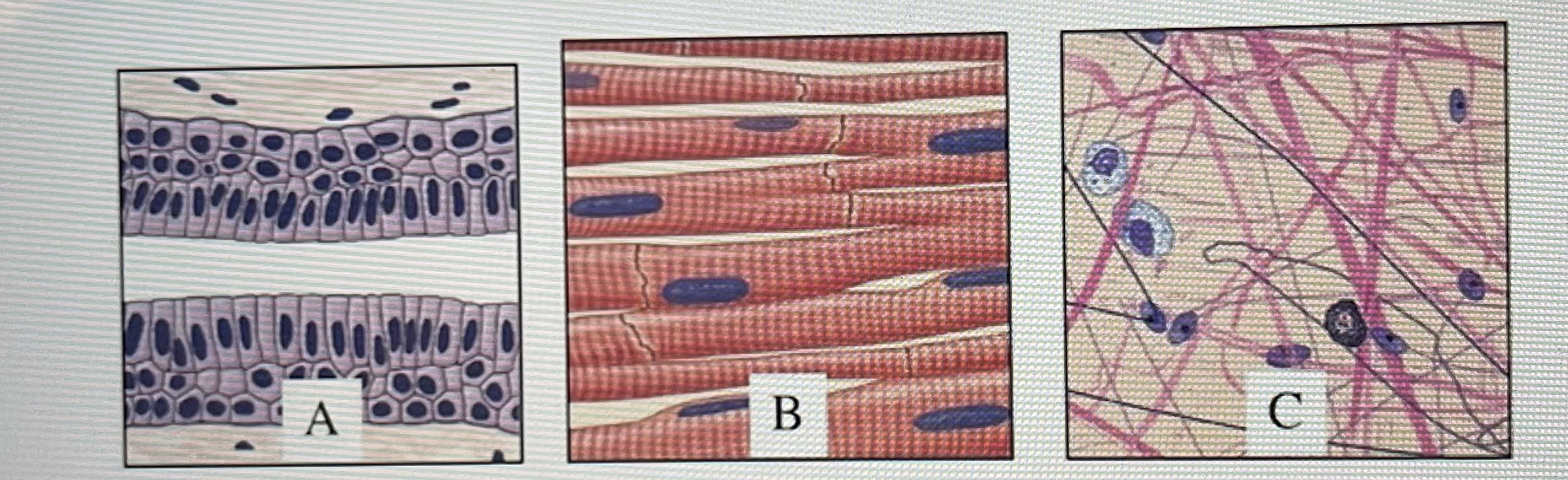 For the image above select the group of terms that correctly identifies each tissue 