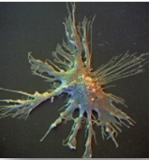 <p>antigen-presenting cells (APC) &amp; are classified according to their location. capture antigen in tissues and then go to lymphoid organs to present the antigen to T lymphocytes. more potent APCs than macrophages or B cells.</p>