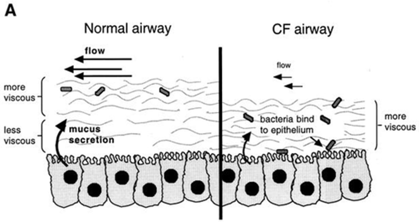 <p>Give saline - ENaC are active so it gets cleared quickly.</p>