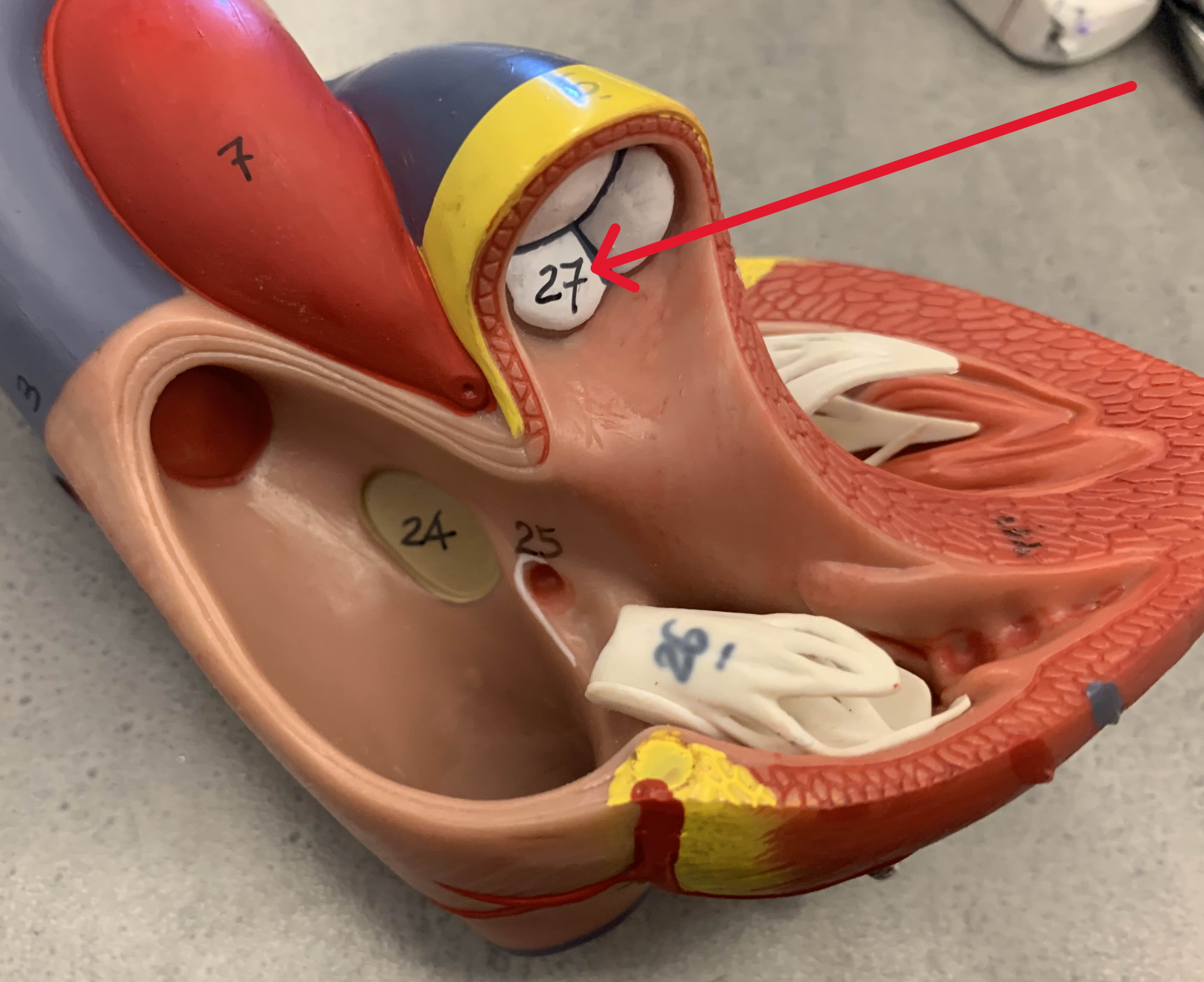 <p>Which valve of heart:</p><ul><li><p>Between <u>right</u> ventricle and pulmonary trunk</p></li></ul><p></p>