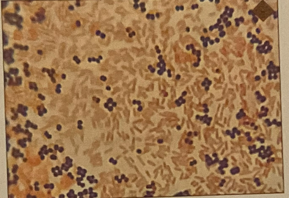 <p>gram staining </p>