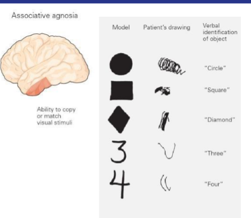 <p>Associative agnosia</p><p>What it is and what are people unable to do </p>