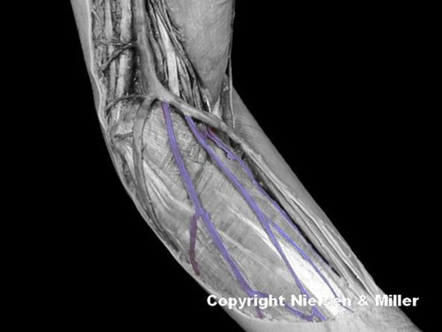 <p>Identify the highlighted vessel.</p>