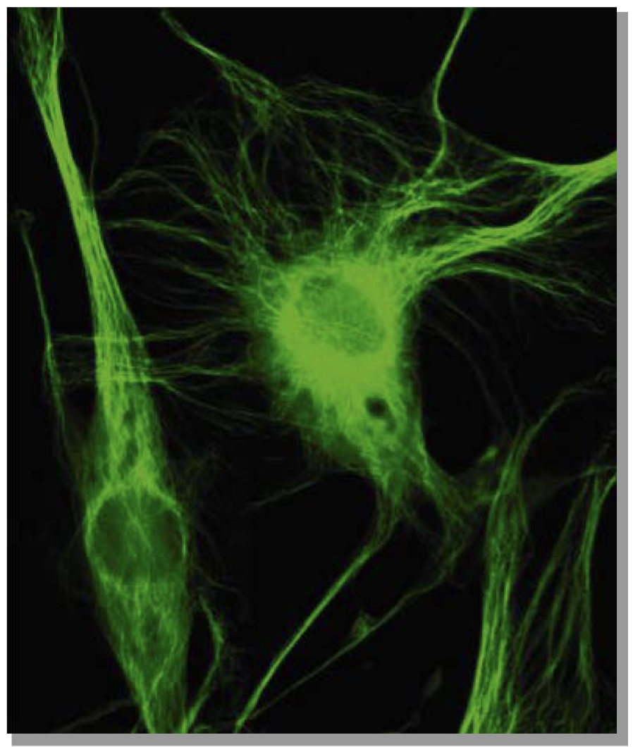 <p>-tubuline et protéines associées</p><p>-role majeur dans le transport axonal</p>