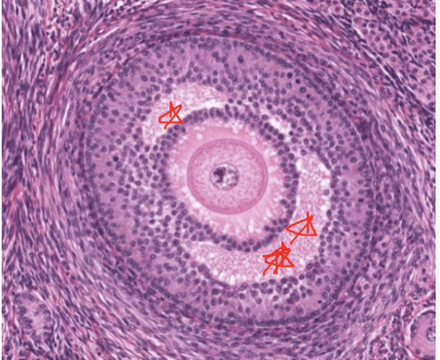 <p>Identify the stage of the follicle</p>