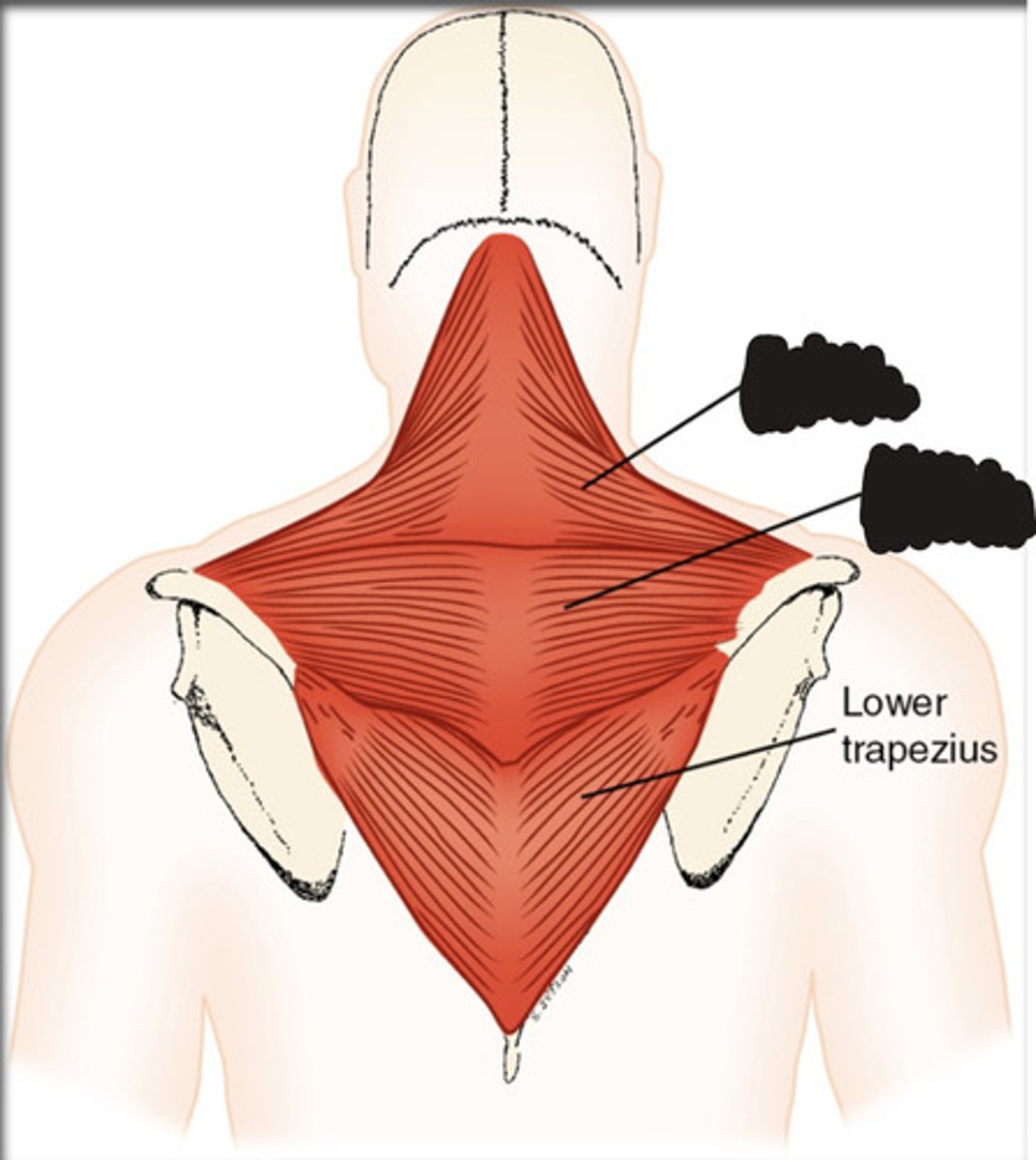 <p>What muscle is this?</p>