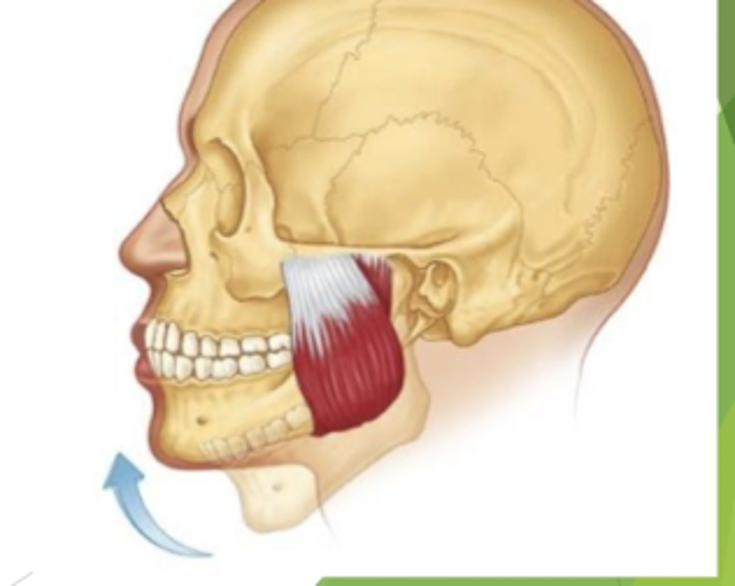 <p>origin: zygotmatic arch </p><p>insertion: gonial angle of the lateral mandible </p>