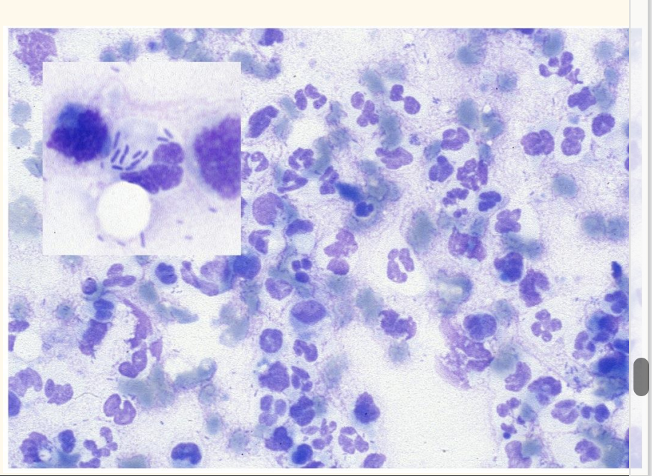 <p>Interpret this otic impression smear</p>